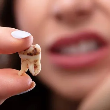 REDUCED RISK OF TOOTH DECAY